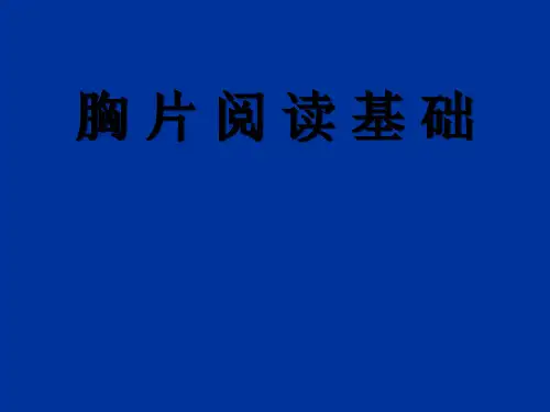 胸片阅读ppt