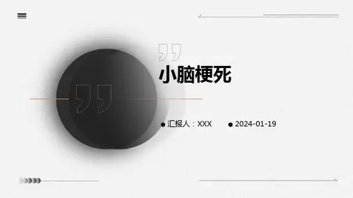 小脑梗死演示ppt课件