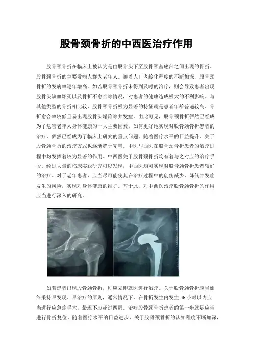 股骨颈骨折的中西医治疗作用