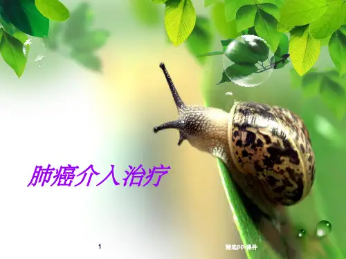 《肺癌介入治疗》PPT课件