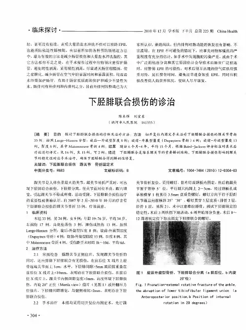 下胫腓联合损伤的诊治
