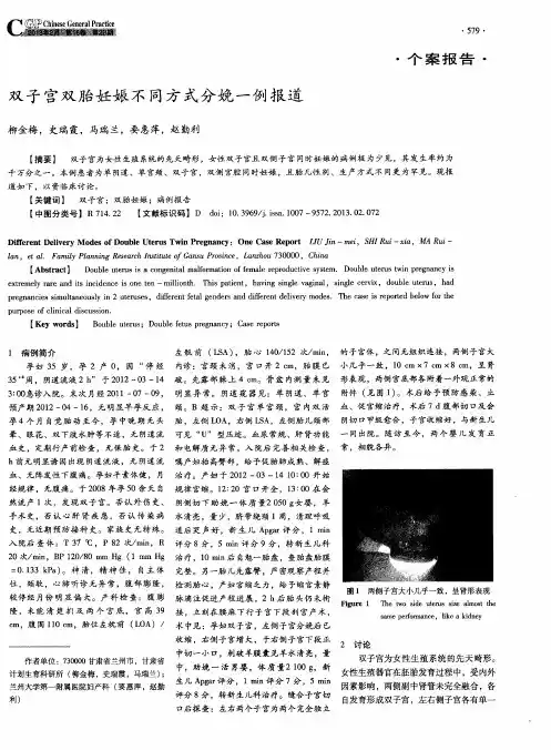 双子宫双胎妊娠不同方式分娩一例报道
