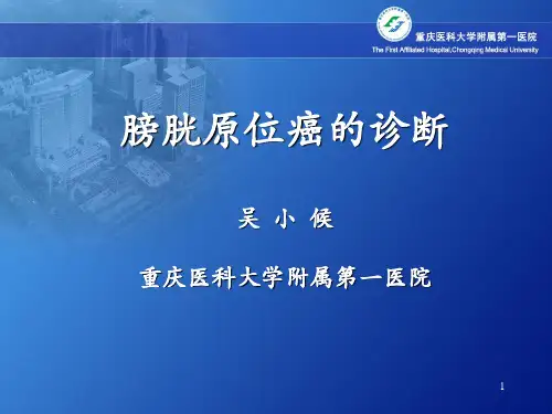 膀胱原位癌诊断ppt课件