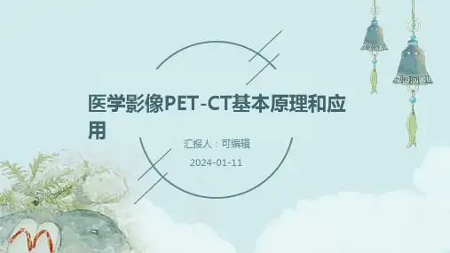 医学影像PETCT基本原理和应用