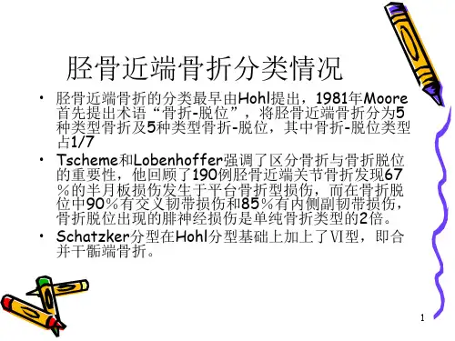 胫骨平台骨折脱位