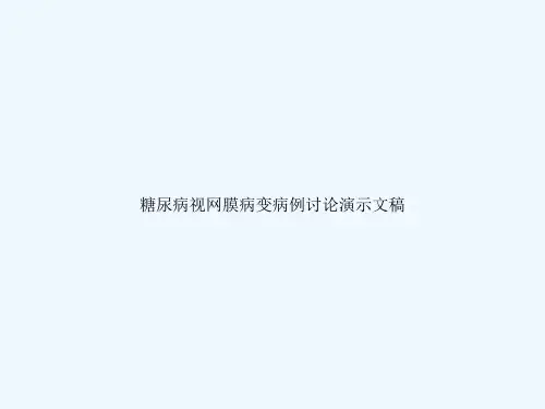 糖尿病视网膜病变病例讨论演示文稿