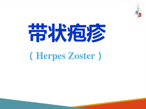 病毒性皮肤病—带状疱疹的诊疗(皮肤性病学课件)