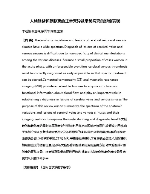 大脑静脉和静脉窦的正常变异及常见病变的影像表现
