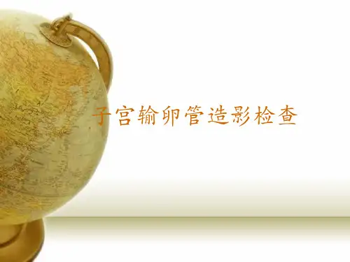 子宫输卵管造影检查