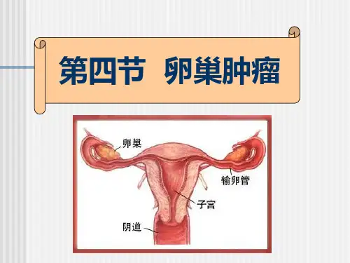 卵巢肿瘤 卵巢肿瘤患者的护理