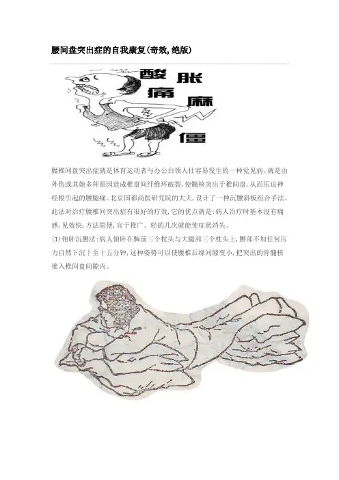 腰间盘突出症的自我康复