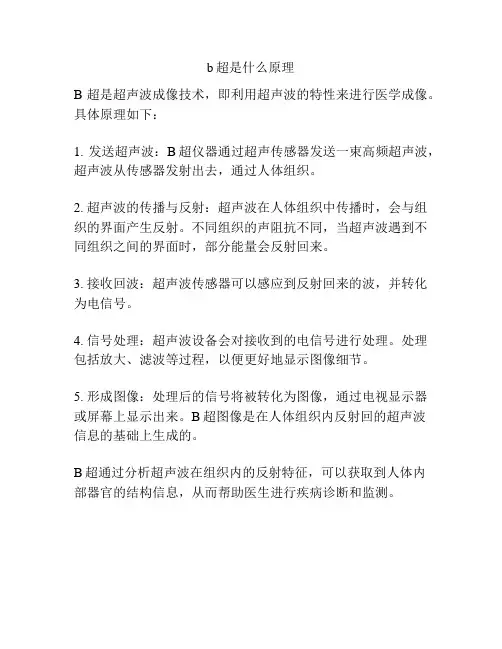 b超是什么原理