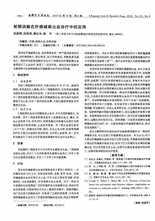 射频消融在肝癌破裂出血治疗中的应用