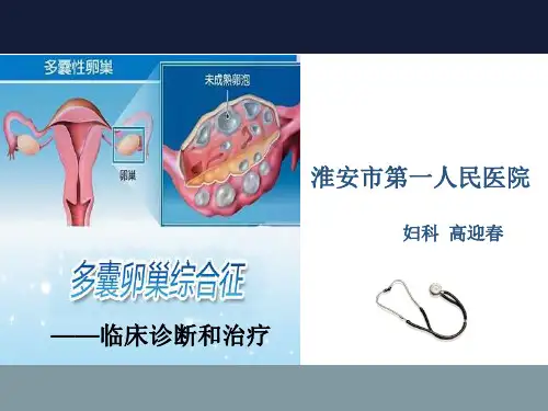 多囊卵巢综合征