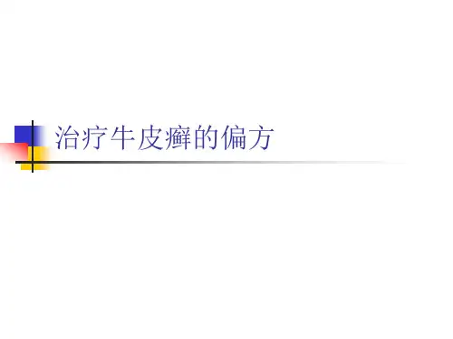 治疗牛皮癣的偏方