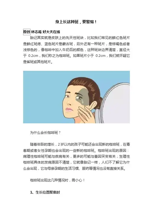 身上长这种斑，要警惕！