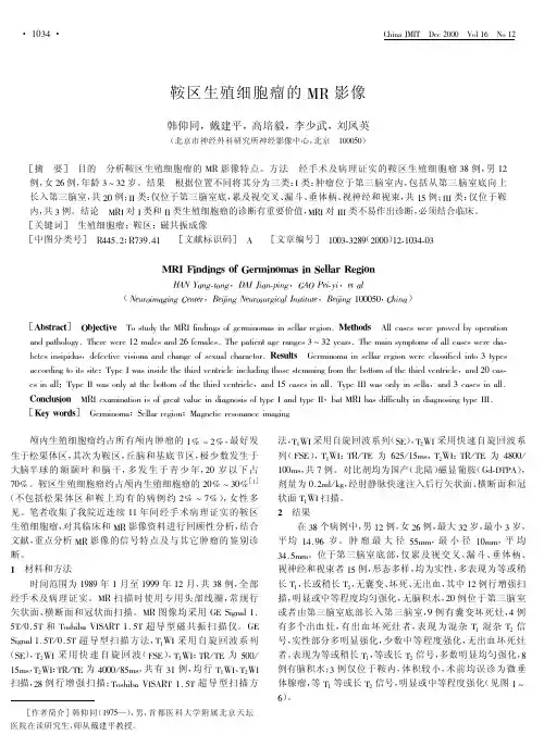 生殖细胞瘤
