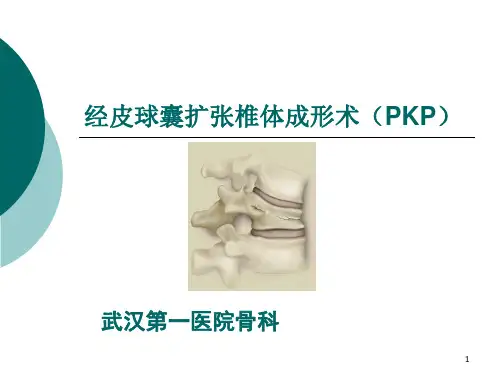 经皮球囊扩张椎体成形术(PKP)PPT课件