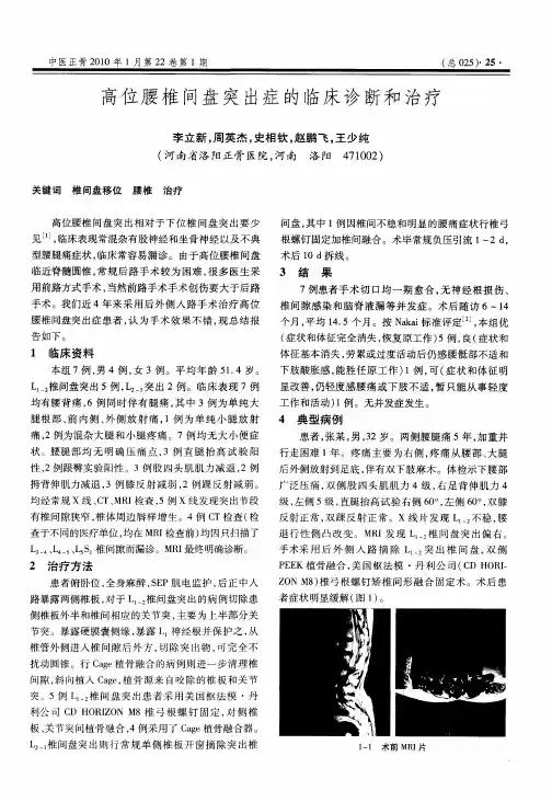 高位腰椎间盘突出症的临床诊断和治疗