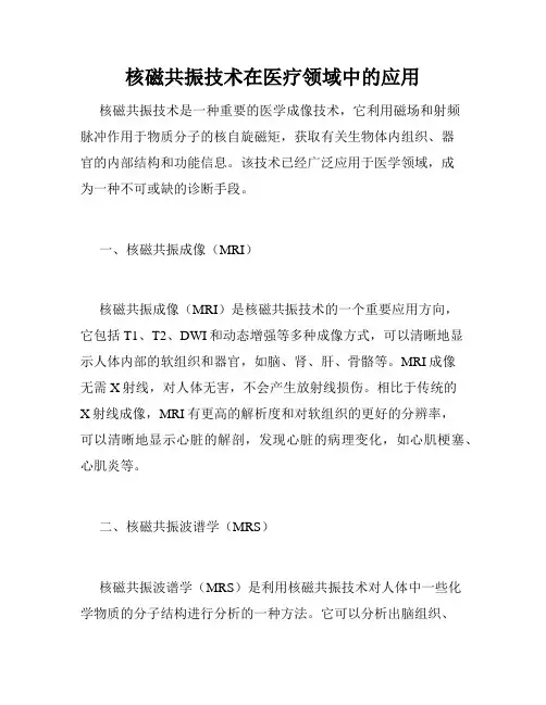 核磁共振技术在医疗领域中的应用