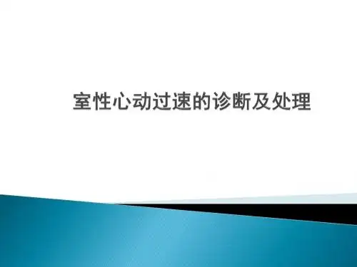 室性心动过速诊断及处理