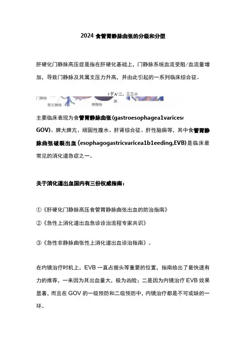 2024食管胃静脉曲张的分级和分型