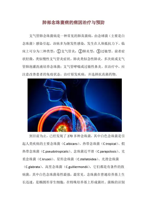 肺部念珠菌病的病因治疗与预防