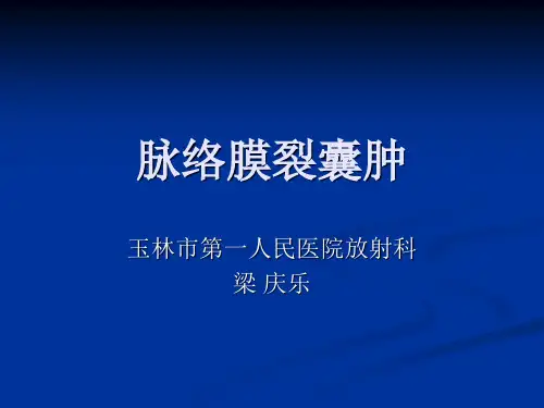 脉络膜裂囊肿