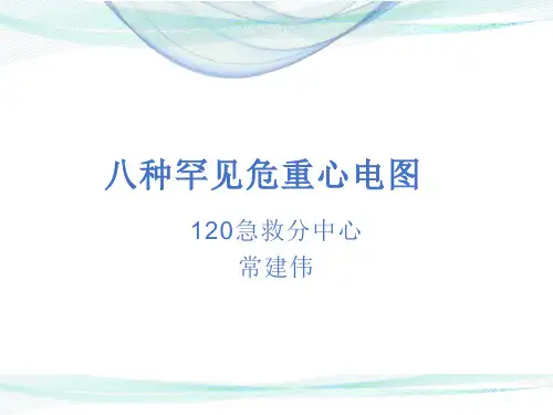 8种危重症心电图表现
