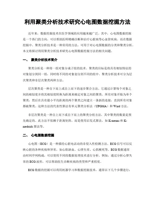 利用聚类分析技术研究心电图数据挖掘方法