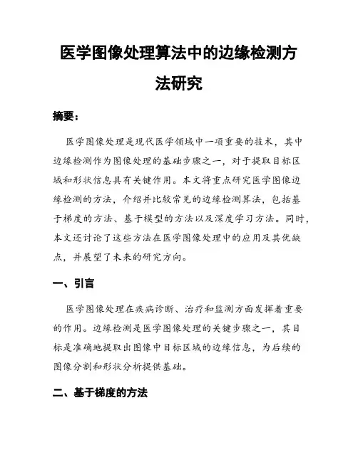 医学图像处理算法中的边缘检测方法研究