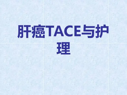 肝癌TACE