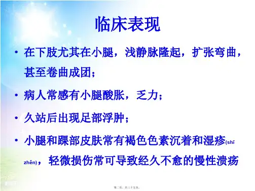 202X年刘怡下肢静脉曲张的超声检查