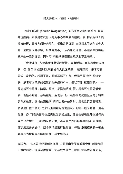 绝大多数人不懂的X线病例