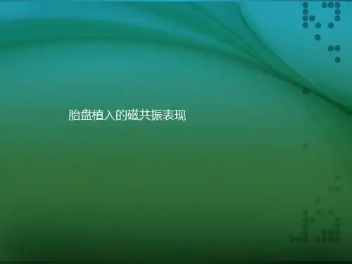 胎盘植入的磁共振表现ppt课件