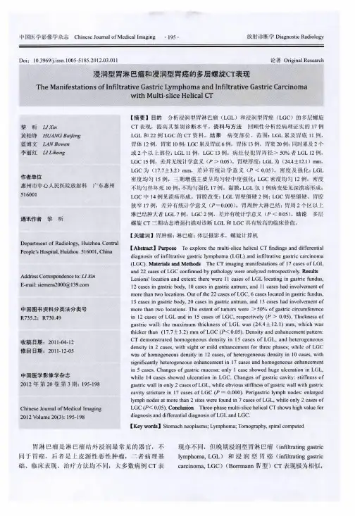 浸润型胃淋巴瘤和浸润型胃癌的多层螺旋CT表现