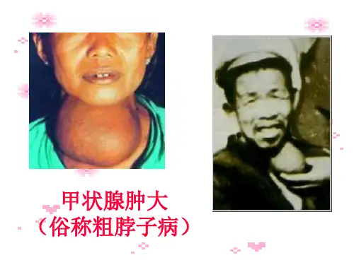 人教版九年级化学第十二单元课题2《化学元素与人体健康》PPT课件(共36张PPT)