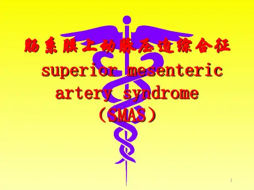 肠系膜上动脉压迫综合征PPT课件