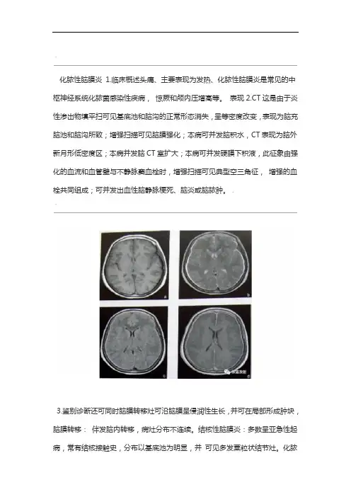 7种颅内感染