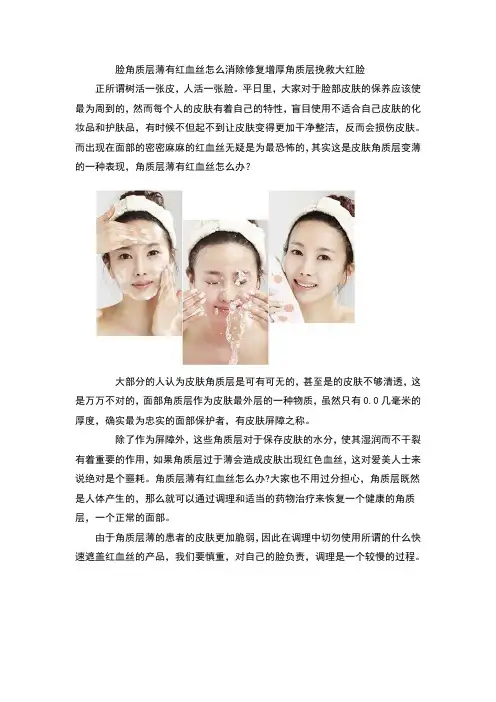 脸角质层薄有红血丝怎么消除 修复增厚角质层挽救大红脸