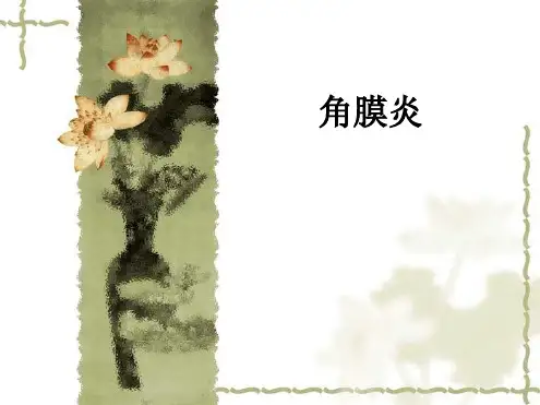 角膜炎ppt课件