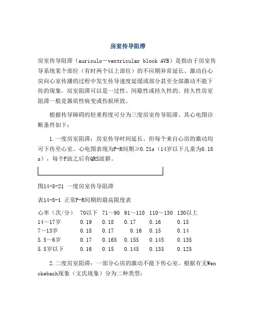 房室传导阻滞