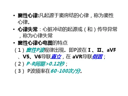 常见心律失常PPT课件