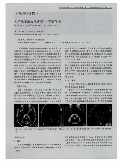 多系统萎缩表现典型“十字征”1例