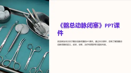 《髂总动脉闭塞》课件