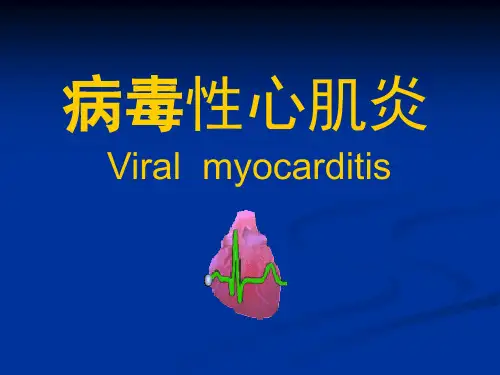 七版病毒性心肌炎