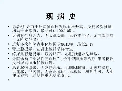 内分泌科病例讨论课件