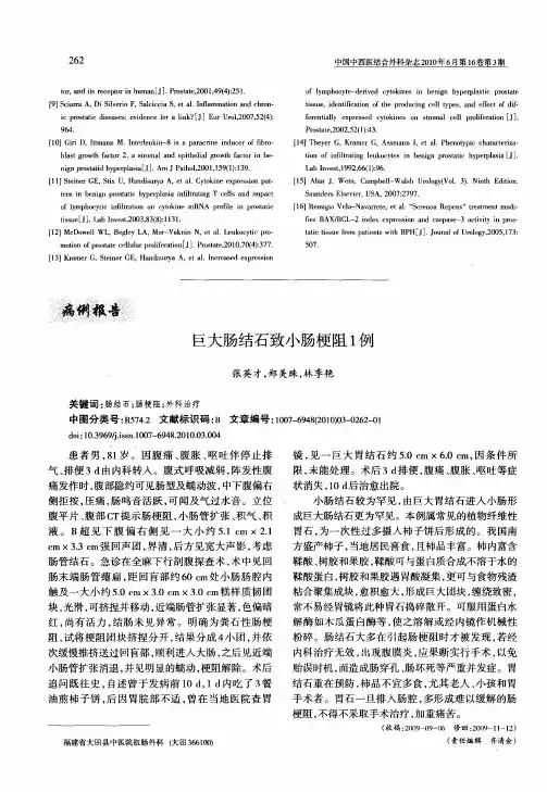 巨大肠结石致小肠梗阻1例