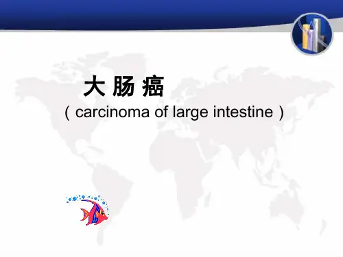肠癌PPT