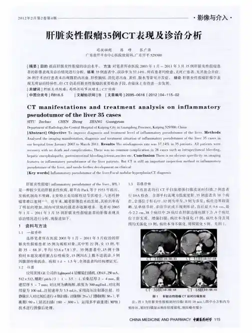 肝脏炎性假瘤35例CT表现及诊治分析